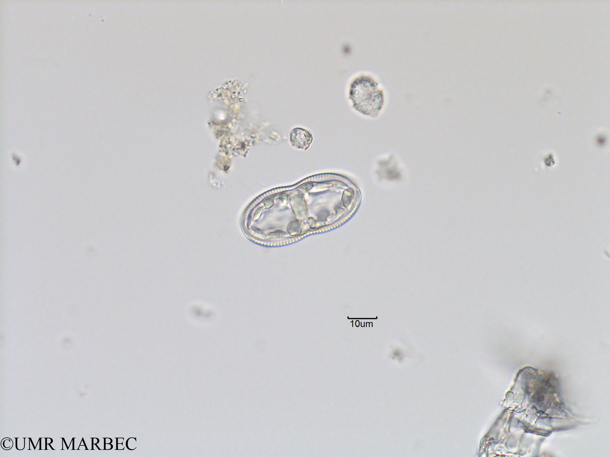 phyto/Bizerte/bizerte_bay/RISCO November 2015/Diploneis spp (Baie_T5-ACW2-Navicula-4).tif(copy).jpg